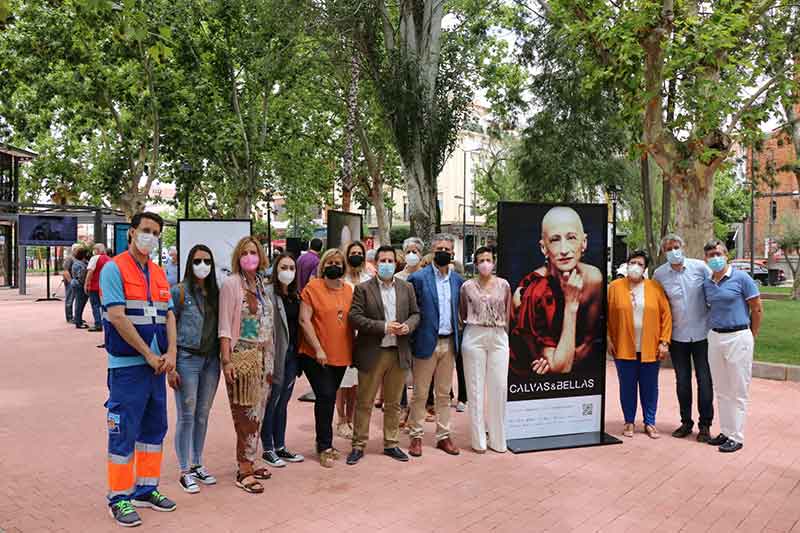 Exposicin Calvas & bellas 